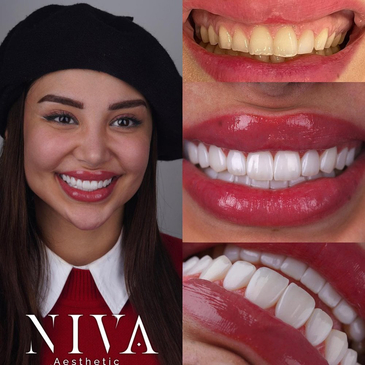 Slider image (3) Best Dental Clinic in Istanbul - Niva Aesthetic